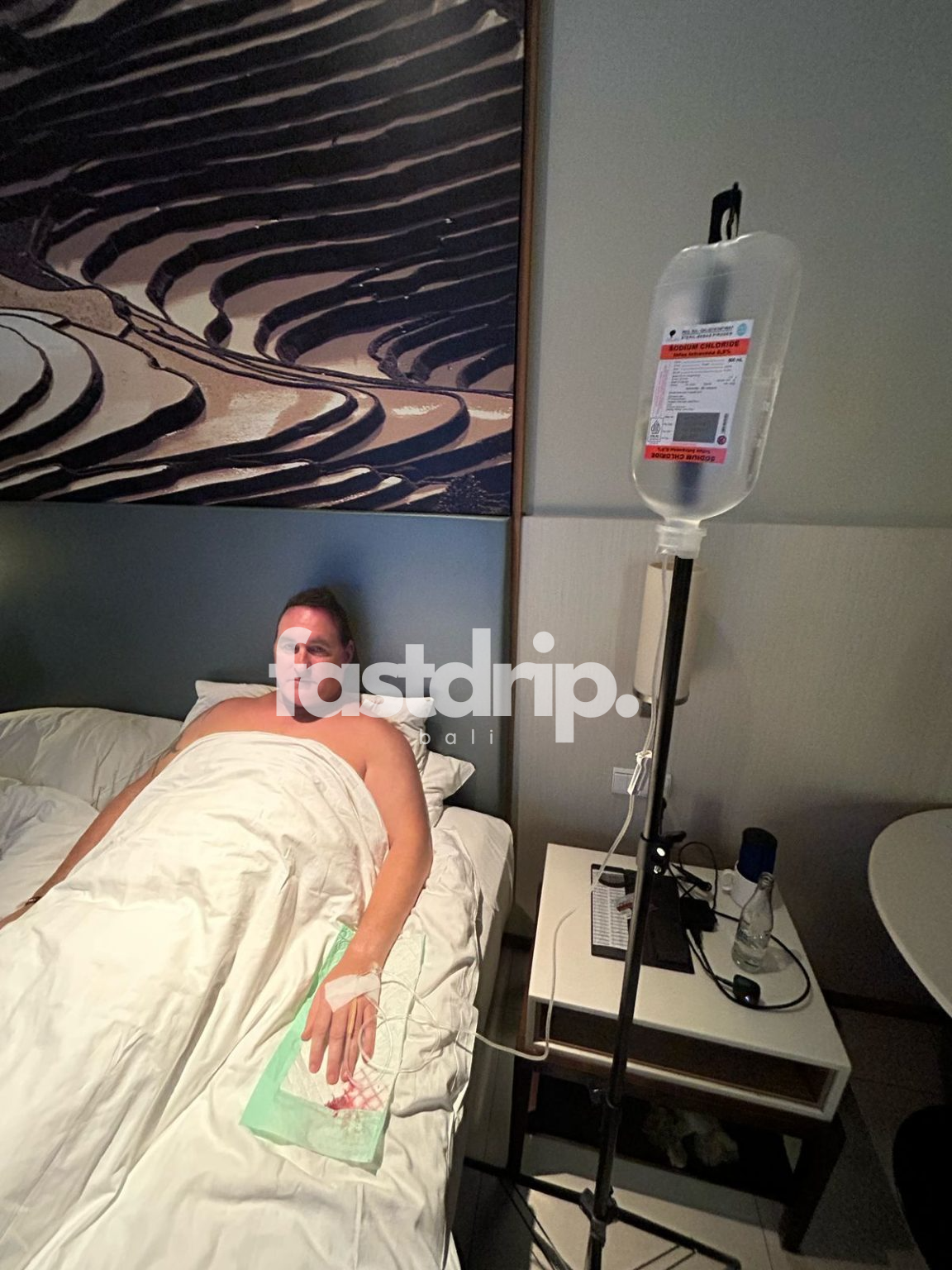 IV Drip Bali - Preventing Bali Belly: Essential Tips for Tourists