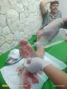 Seminyak Wound Treatment