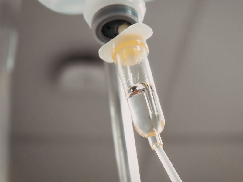Multivitamin IV Infusion Benefits for Daily Wellness