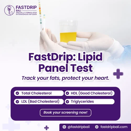 lipid panel test